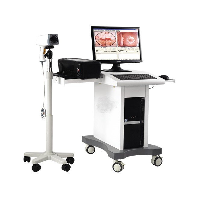 Colposcope Video Machine for Gynaecology MDLCE06