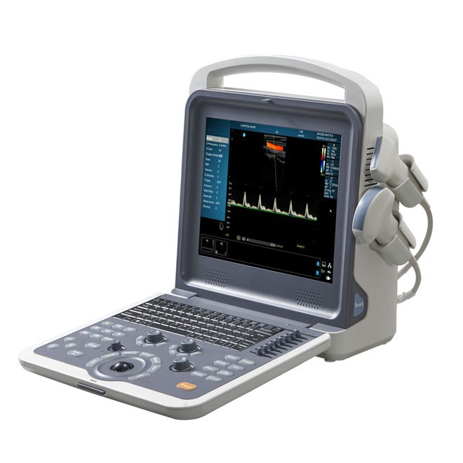 Portable Color Doppler Ultrasonic Diagnostic System MDLCU62
