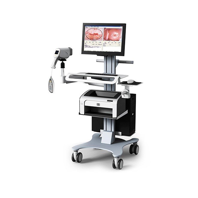 Multi-functional Trolley Colposcope Video Machine MDLCE08