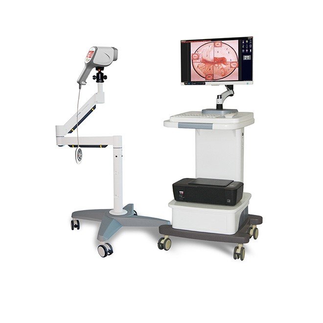 Portable Gynaecology Digital Colposcope System MDLCE07