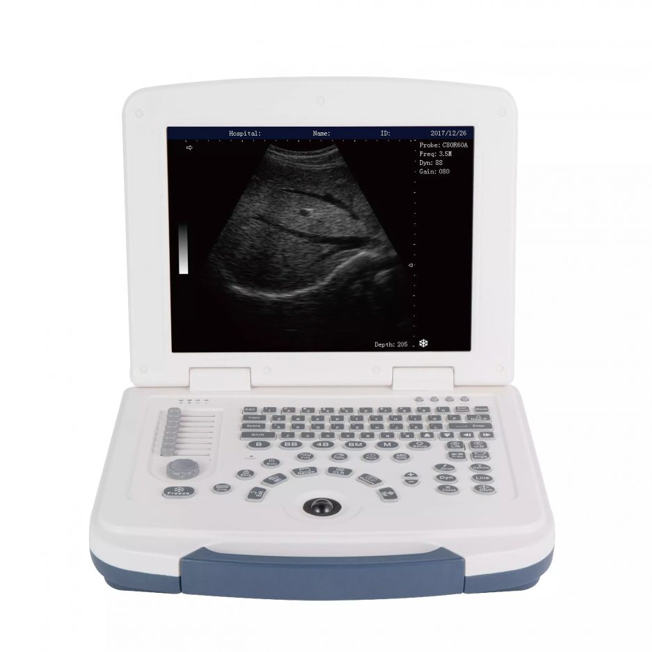 First-Class Digital Imaging B/W Ultrasound Machine MEK-580