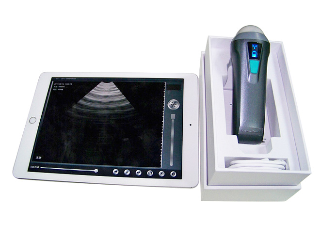 3 in 1 Wireless Probe Type Ultrasound Scanner Machine MSLPU78
