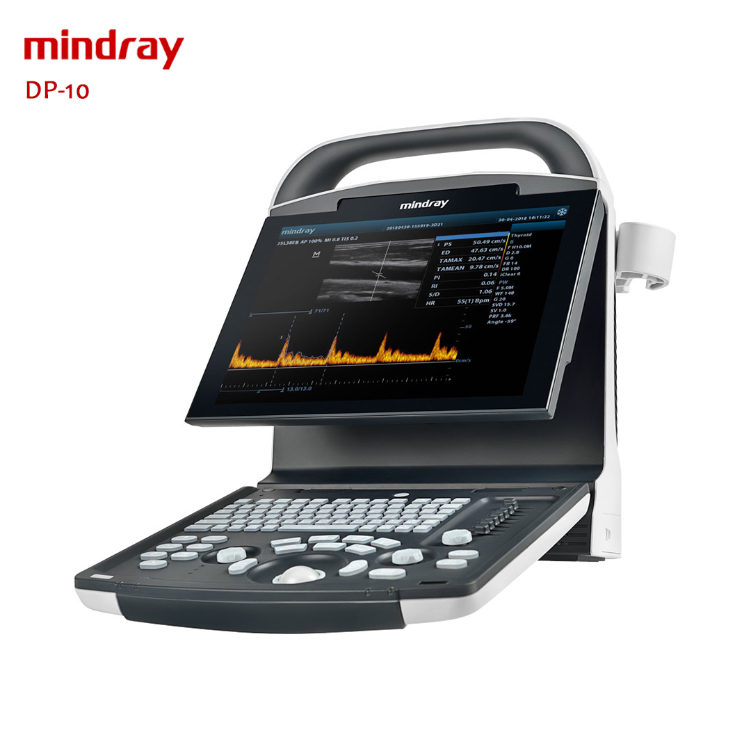 Portable Ultrasound Machine Mindray DP-10 - Medical Devices